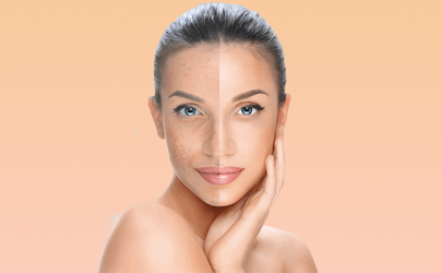 Best ceramides for skin whitening 